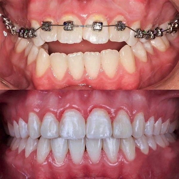 Dentist performing orthodontic treatment at Rajarhat Dental Hall