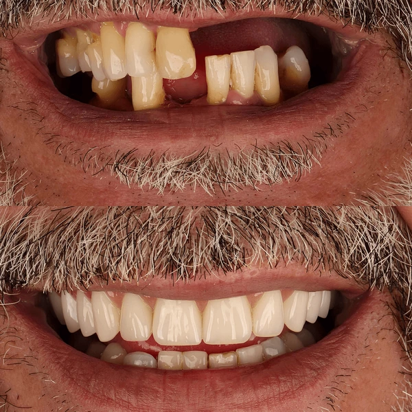 Denture Doctor in Rajarhat